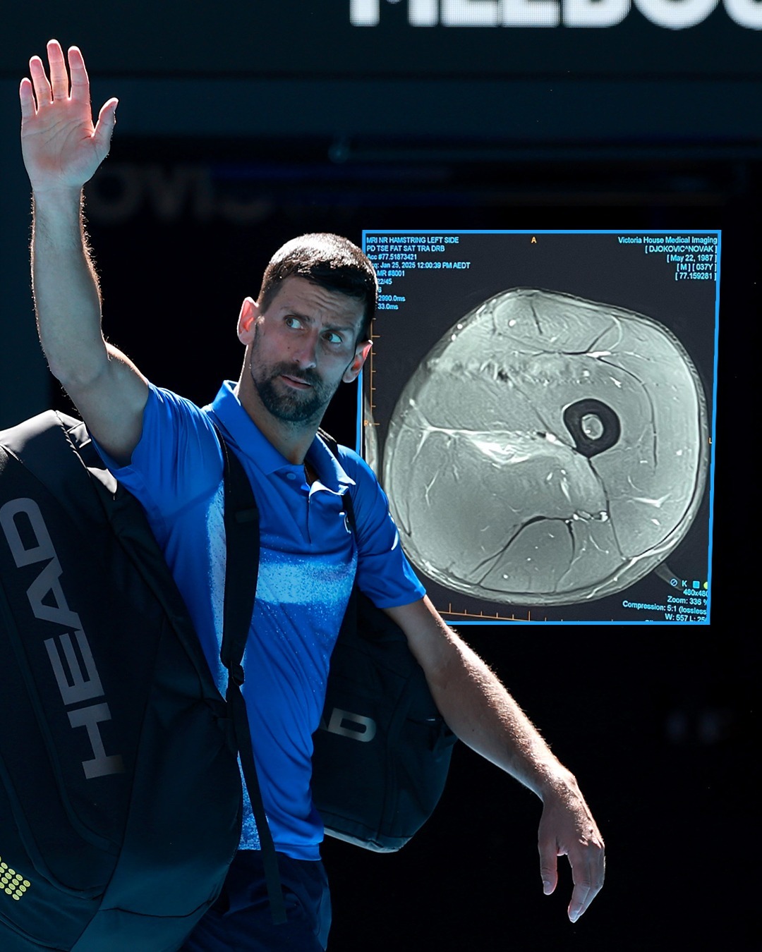 PG电子娱乐-包含德国网球队爆冷日本网球队，德约科维奇送出助攻的词条